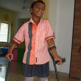 An artificial limb for  the physically challenged